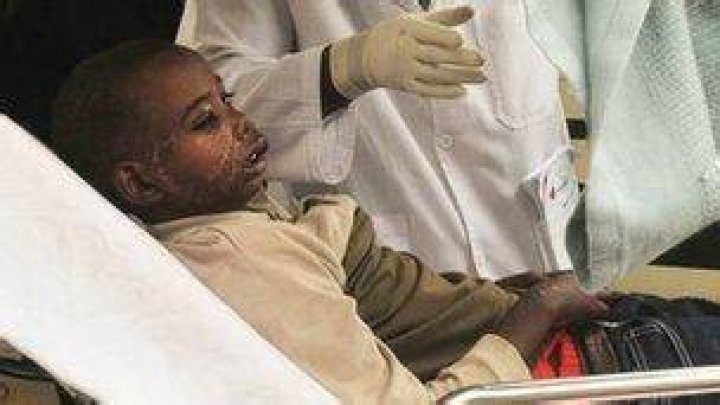 Musa Jelle was mauled by hyenas as he slept