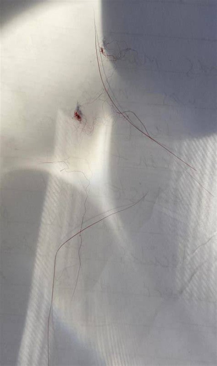Red lint and synthetic hairs were stuck all over the sweater