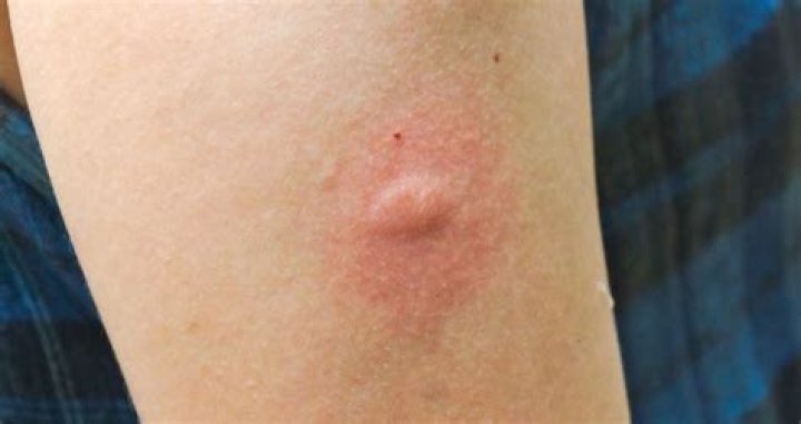 Red shows where the mosquitos are active and orange sporadic sightings in the past five years