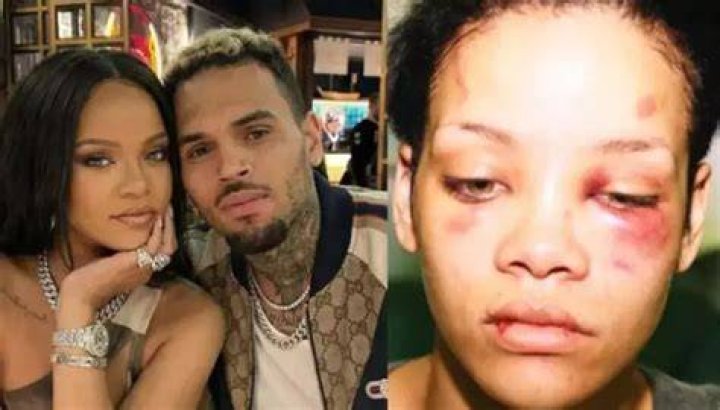 Rihanna bruised her face and forehead during a scary e-scooter crash 