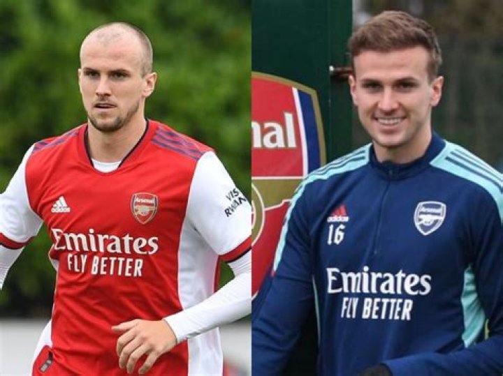  Rob Holding was bald before he went to the clinic