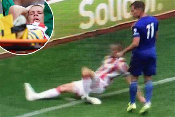  Ryan Shawcross suffered a horrific leg injury during Stoke's pre-season game against Leicester