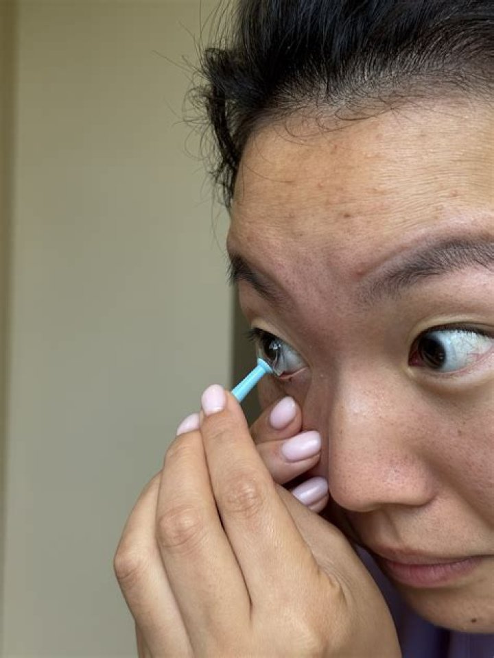 She rinsed the lens out with tap water and put it back in her eye - but later developed an infection
