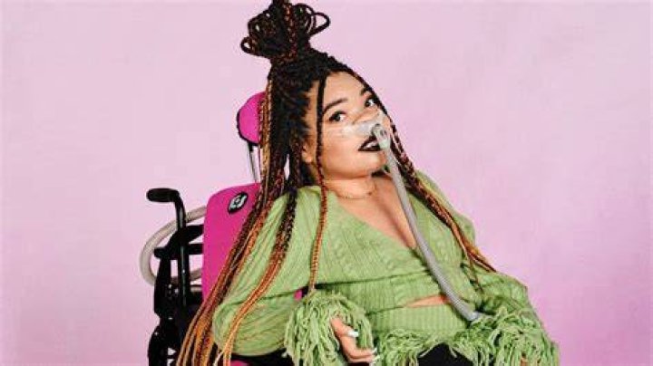 She uses her platform to educate her 580,000 TikTok followers about fitness and cleft