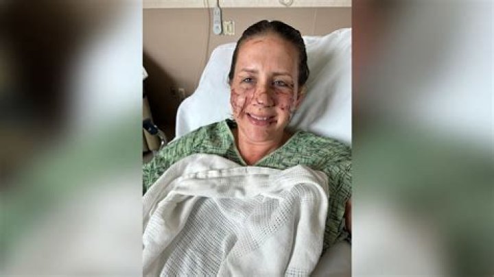 She was attacked in her hotel room after a night out while appearing on the X Factor