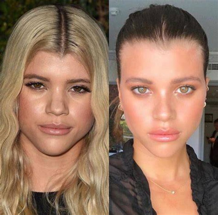 Sofia Richie Gets Laser Before Wedding - 412
