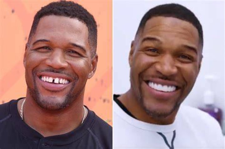 Strahan had his teeth done with Dr. Lee Gause at Smile Design Manhattan