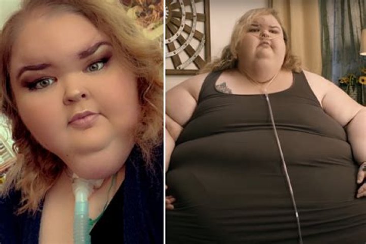 Tammy lost 115 pounds in 30 days in rehab