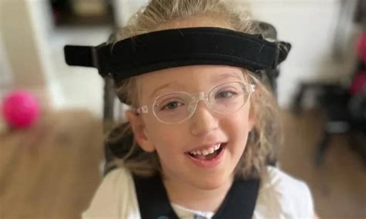 The condition has left her with nasty sores, bruises and broken skin on her legs, as well as crippling pain