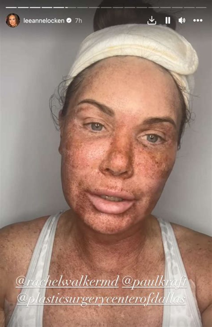 The RHOD star also said this is the 'most thankful yet pain I've ever felt'