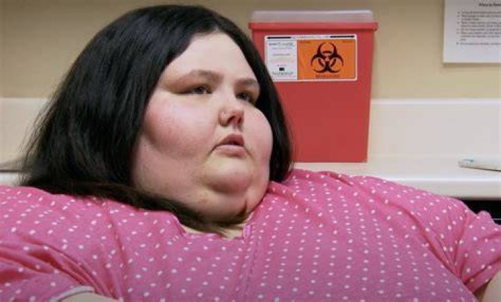 The show documented the painful recovery Jade underwent following the procedures