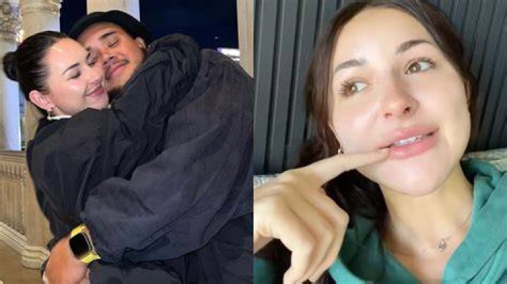  The TikTok star broke her nose last year