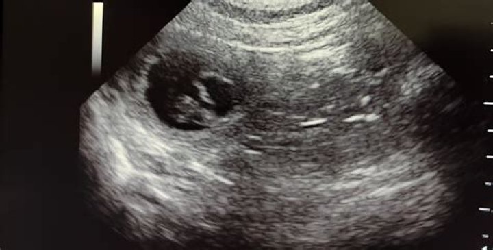  They confirmed the pregnancy in April