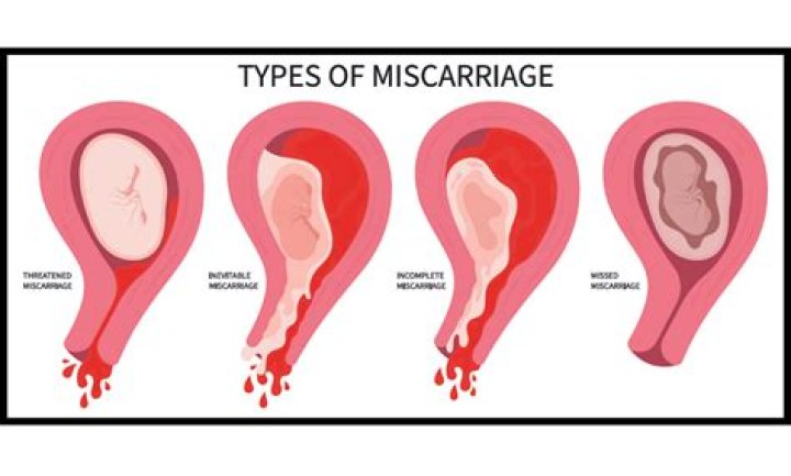 They suffered a miscarriage before Jinger learned of her current pregnancy 