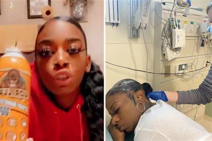 TikToker Tessica Brown is set to sue Gorilla Glue after its product remained stuck on her head over a month after she applied it