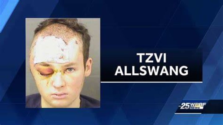 Tzvi Allswang, seen in a mugshot, faces multiple felony charges for the alleged attack