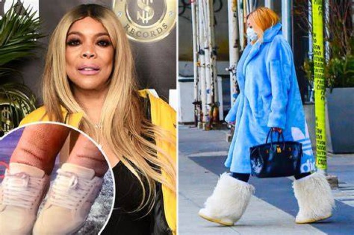 Wendy Williams hid her swollen ankles while on a walk this week