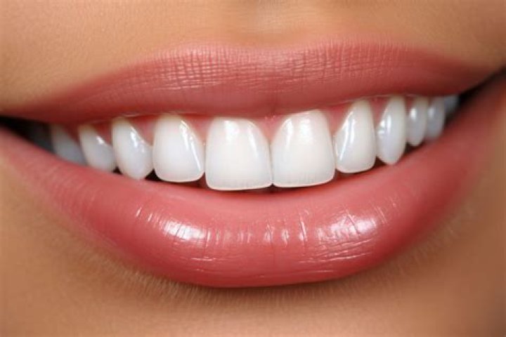 white-teeth