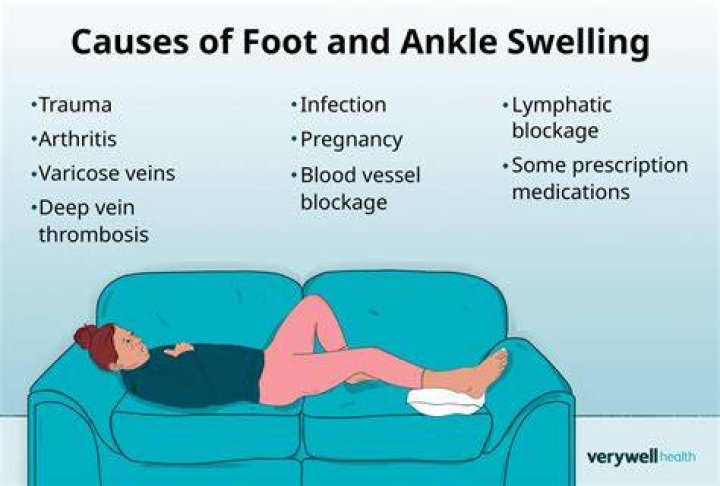 Your feet may swell in hotter weather or if you have been standing or sitting for long periods